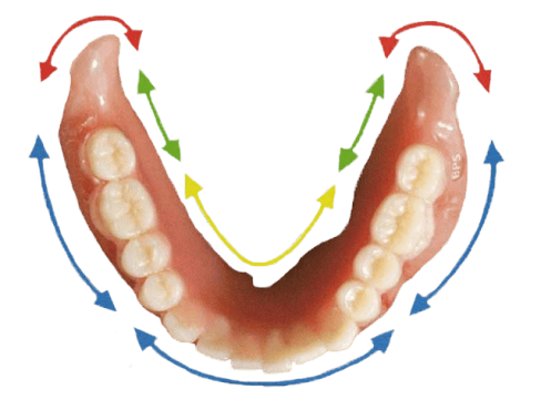 Lower suction dentures