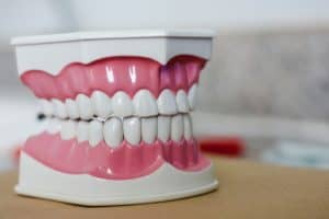 An example of traditonal dentures